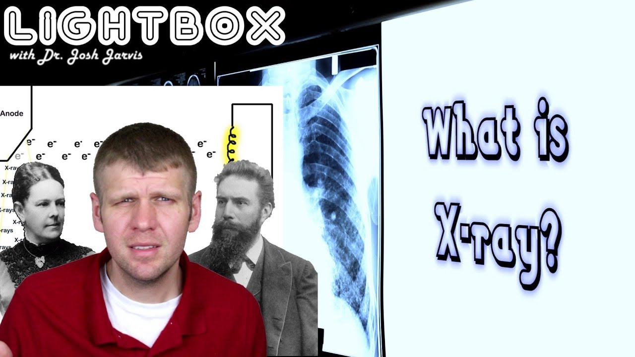 What is Xray? Lightbox episode 2 YouTube