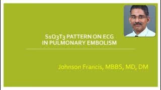 S1Q3T3 Pattern on ECG in Pulmonary Embolism