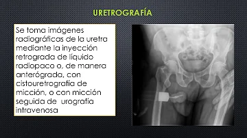 Perché si fa la Cistografia?