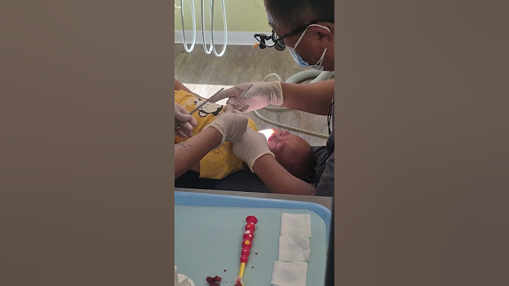 Dentist visit drama – Asher cries during his checkup 😢🦷💔 | Day 572