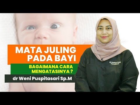 Video: Apakah semua bayi baru lahir terlihat juling?