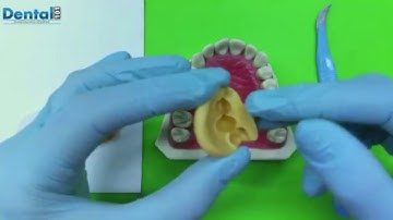 How to make a good Putty Key🦷