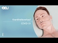 Coronavirus COVID-19 - Krankheitsverlauf