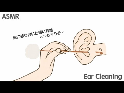 【ASMR】壁に張り付いた薄い耳垢を剥がすごりごり耳かき Ear Cleaning 【No Talking】