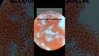 Кровь человека под микроскопом (640x) #микроскоп #microscope #макро #macro