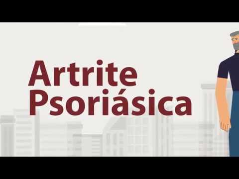 Vídeo: Psoríase E Artrite Psoriática: Como Eles Estão Conectados?