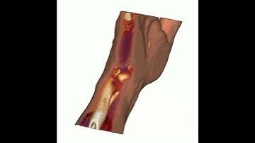 Illustrative Context-Preserving Exploration of Volume Data (1)