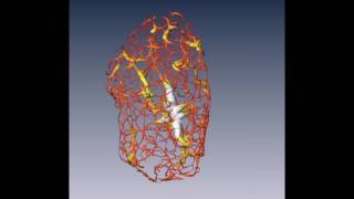 DNA reorganization in a mouse cell's nucleus