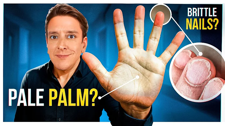 Nutrient Deficiencies Revealed by your Hands