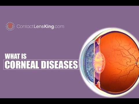 Corneal Diseases of the Eye | Keratoconus, Fuchs&rsquo; Endothelial Dystrophy, Bullous Keratopathy