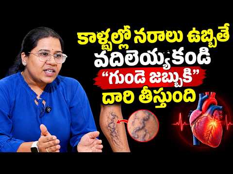 కాళ్ళల్లో నరాలు ఉబ్బితే గుండె జబ్బుకి దారి తీస్తుంది | Varicose Veins | Dr Lakshmi | AVIS Hospitals