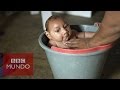 Zika: ¿Cómo es la vida del bebé con microcefalia de esta famosa foto?