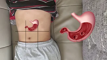 Quels sont les organes Intrapéritonéaux ?