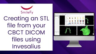 Tutorial: Creating an STL file from your CBCT DICOM files using Invesalius
