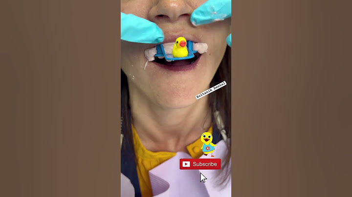 I love these molds! 😲 #shorts #viral #teeth #short