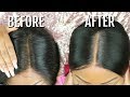 Fake Scalp Method | How To Hide The Lace/Grides On Lace Frontal Wig | No Bleaching | Hot Beauty Hair