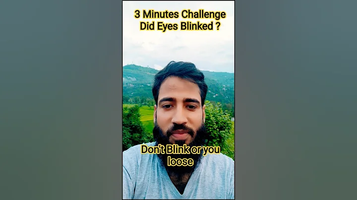 Eyes Blinking Challenge 😳 | Only 1% Can Win This! | Don’t Blink Remix 🫣 #shorts