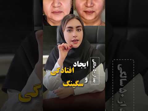 برای مشاوره رایگان و راهنمایی بیشتر به شماره زیر در واتساپ پیام دهید 00989331034349 09331034349