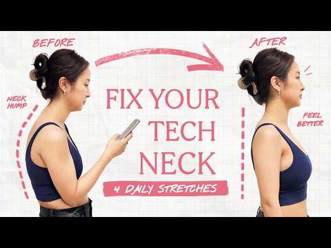 I fixed my BAD posture with 4 easy stretches *expert approved*