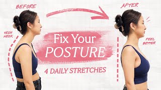 I fixed my BAD posture with 4 easy stretches *expert approved*