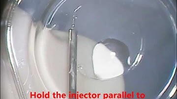 Ophtec CTR Insertion 2012, Jeffrey Whitman, MD