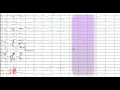 EEG Reading Rounds (EEG in Frontal Lobe Epilepsy)