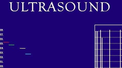 Doom2 music - level 10 played on Gravis Ultrasound