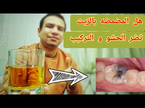 هل المضمضه بالزيت تؤثر علي حشوات الاسنان و التركيبات الثابته