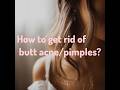 How to get rid of butt acne/pimples? #aesthetic #acne #buttacne #buttpimple #getridofacne #teenagers