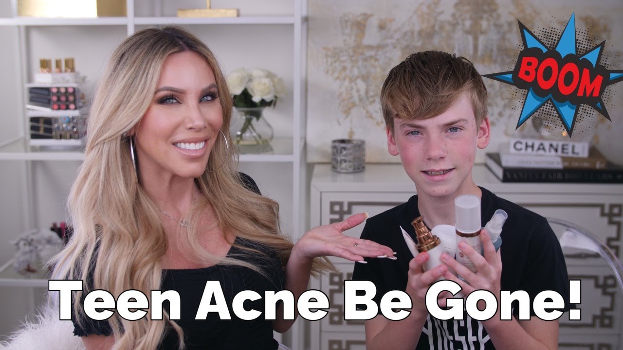 How to Clear Acne Effective Teen Acne Routine with My 13
