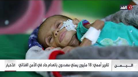 اليمن السعيد.. نصف أهله مهددون بالموت جوعًا "تحذير أممي صادم" بشأن الأوضاع هناك