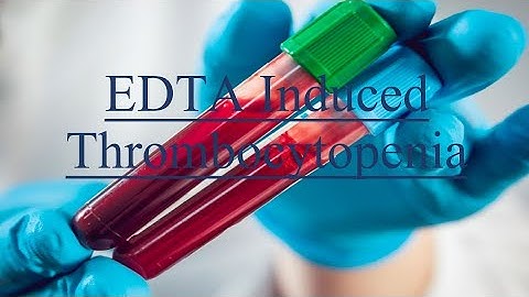 EDTA Induced Thrombocytopenia #aiims #peripheralsmear #laboratorymedicine #hematology #platelets