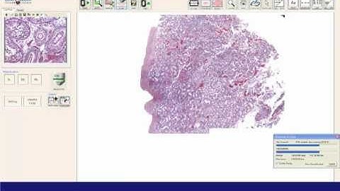 Whole Slide Imaging: Scanning (MikroScan D2)