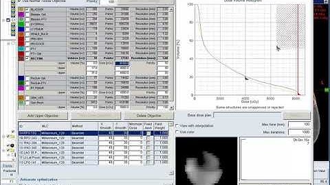 7 Optimization for Prostate IMRT   3