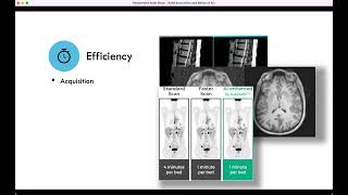 Economics and Ethics of AI