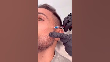 Real Mewing Bro☠️🤫🧏🏻#real #mewing #tutorial #tips #stepbystep #shelove