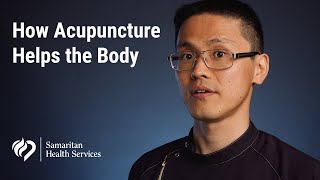 How Acupuncture Helps the Body