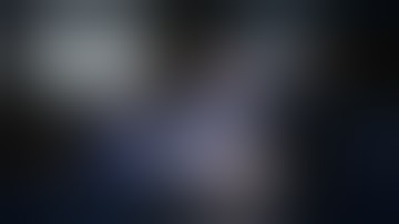 Watch doctor perform robotic-assisted surgery in Syracuse, NY