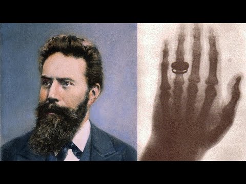 Vidéo: Qu'a découvert Wilhelm Conrad Röntgen ?