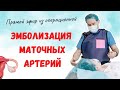 КАК ПРОХОДИТ ЭМБОЛИЗАЦИЯ МАТОЧНЫХ АРТЕРИЙ Прямой эфир из операционной Юсуповской больницы 29/05/2020