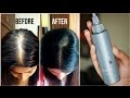 How to increase volume & density of hair? | Amway's Satnique Scalp Tonic Review | Kavya K