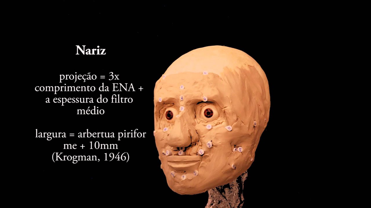 odontologia legal Reconstrução Facial Forense - Indivíduo Feminino
