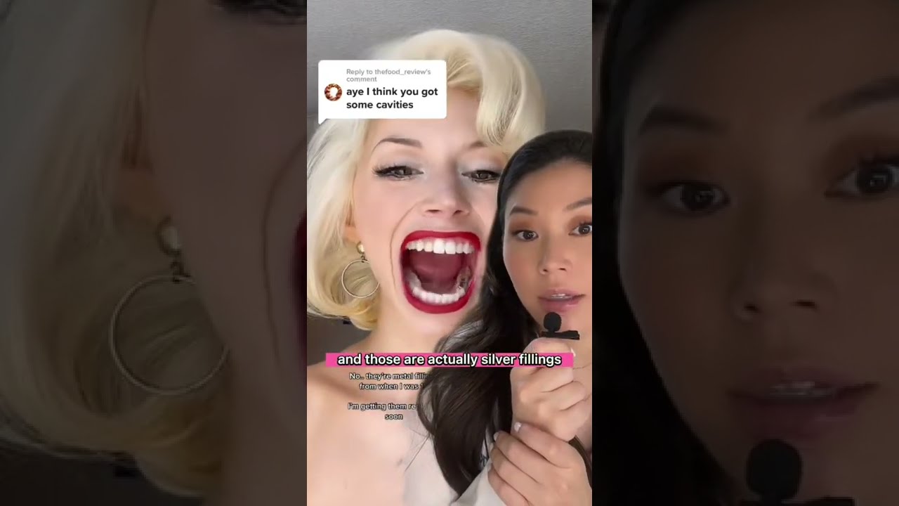 Silver Fillings Are They Bad Cavities Dentist