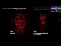 I2k 2020 tutorial quantification of the 3d brain vasculature in zebrafish light shee session 2