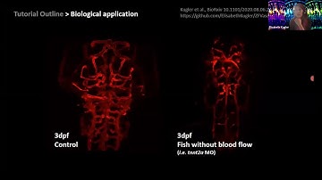 I2K 2020 tutorial: Quantification of the 3D brain vasculature in zebrafish light shee... (session 2)