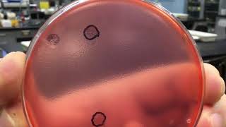 Phage Hunters - Bacteriophages - Allegany College of Maryland