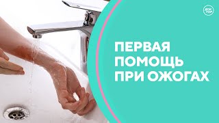 Первая помощь при ожогах. Скажите, доктор!