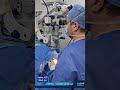 عملية زراعة القرنية مش مجرد تدخل جراحي