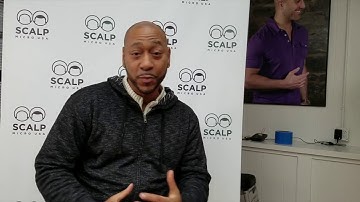 Scalp Micropigmentation Results - Erik