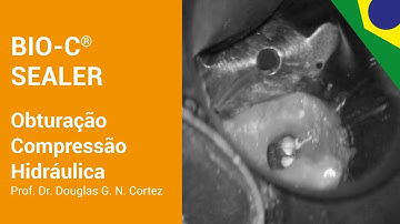 BIO-C SEALER | Obturação Compressão Hidráulica | Prof. Dr. Douglas G. N. Cortez